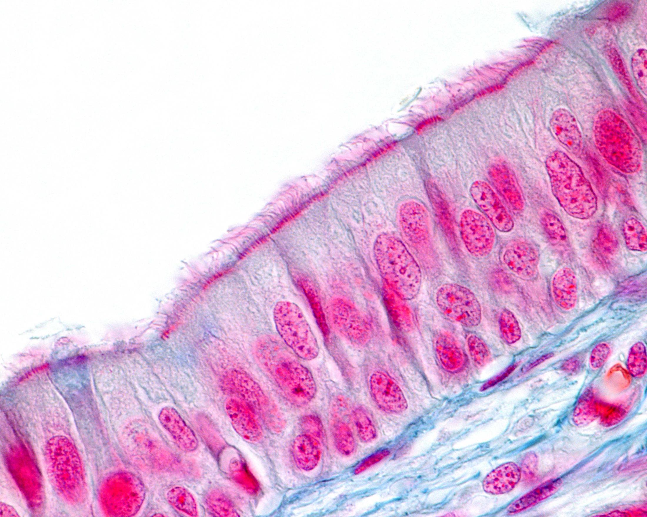 Respiratory epithelial cells