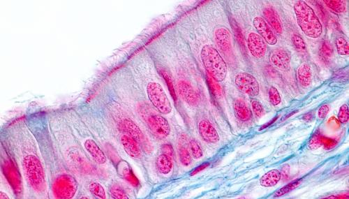 Epithelial cells